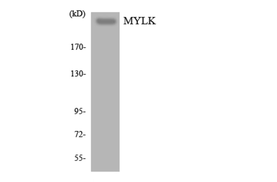 Western Blot - Anti-MYLK Antibody (R12-3069) - Antibodies.com