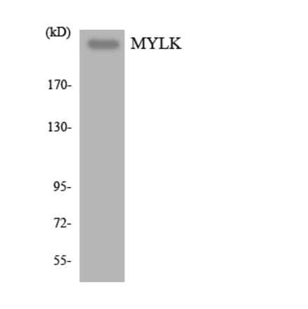 Western Blot - Anti-MYLK Antibody (R12-3069) - Antibodies.com