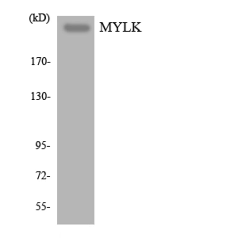 Western Blot - Anti-MYLK Antibody (R12-3069) - Antibodies.com
