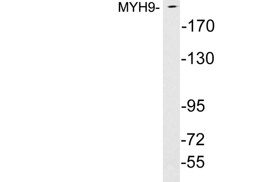 Western Blot - Anti-MYH9 Antibody (R12-2245) - Antibodies.com