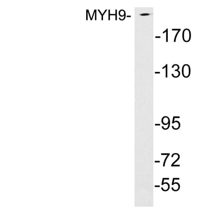Western Blot - Anti-MYH9 Antibody (R12-2245) - Antibodies.com