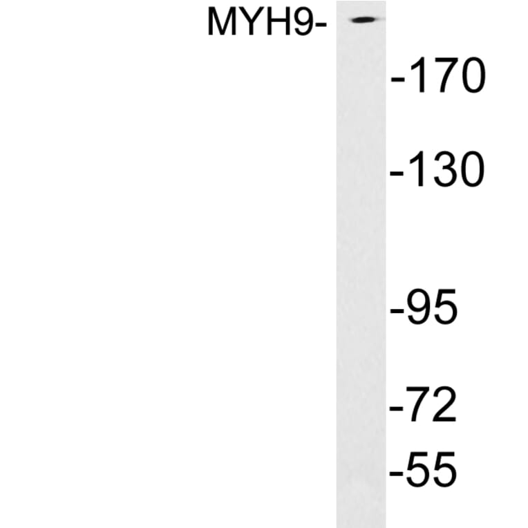 Western Blot - Anti-MYH9 Antibody (R12-2245) - Antibodies.com