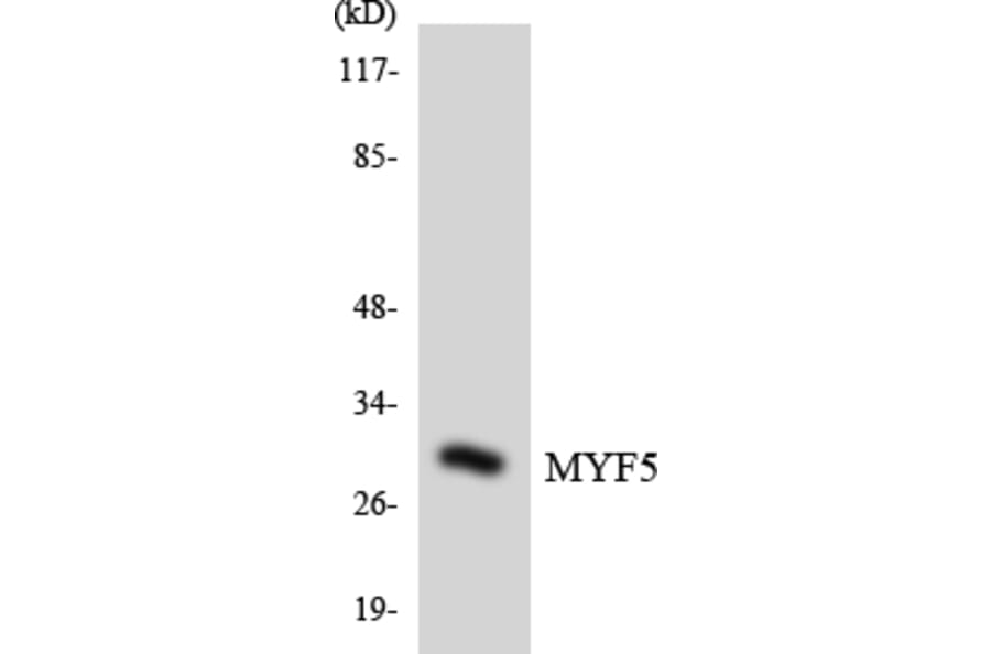 Western Blot - Anti-MYF5 Antibody (R12-3065) - Antibodies.com