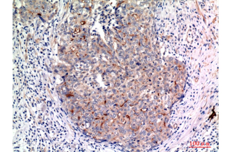 Immunohistochemistry - Anti-MUC1 Antibody (C30467) - Antibodies.com