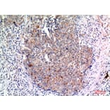 Immunohistochemistry - Anti-MUC1 Antibody (C30467) - Antibodies.com