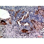Immunohistochemistry - Anti-MUC1 Antibody (C30467) - Antibodies.com