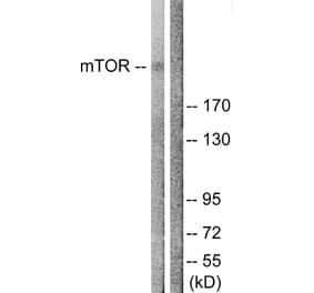 Western Blot - Anti-mTOR Antibody (B1156) - Antibodies.com