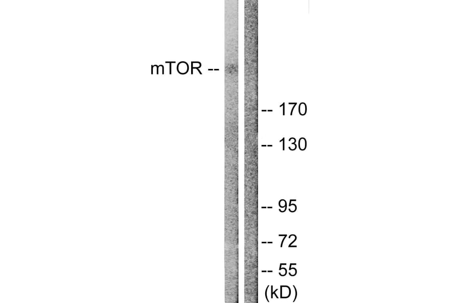 Western Blot - Anti-mTOR Antibody (B1156) - Antibodies.com