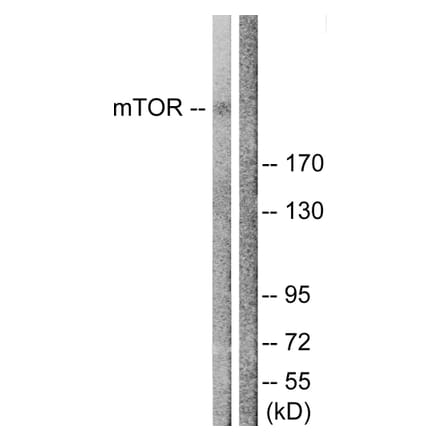 Western Blot - Anti-mTOR Antibody (B1156) - Antibodies.com