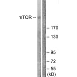 Western Blot - Anti-mTOR Antibody (B1156) - Antibodies.com