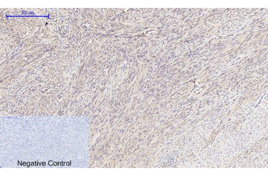 Immunohistochemistry - Anti-mTOR Antibody (B1156) - Antibodies.com