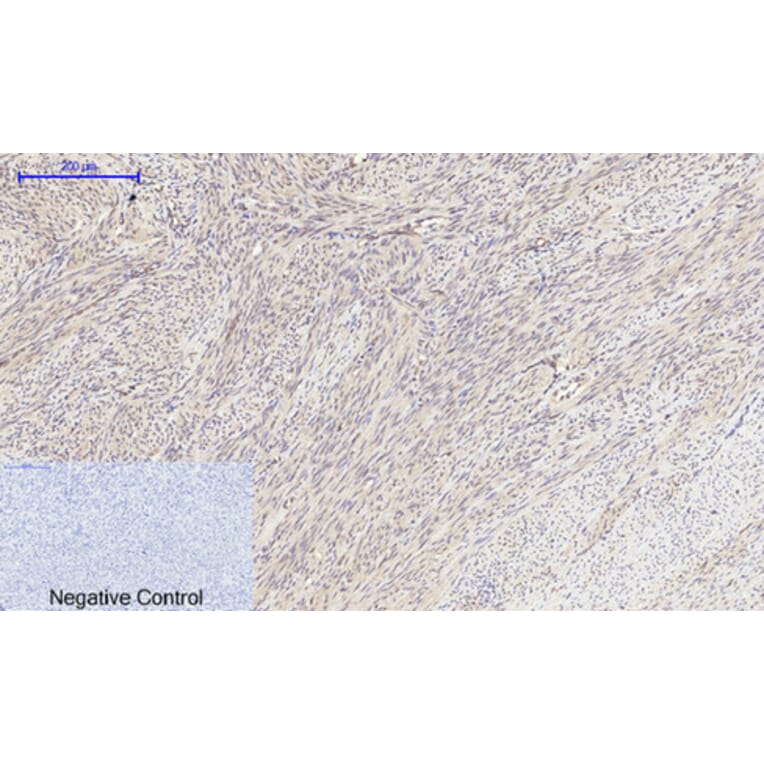 Immunohistochemistry - Anti-mTOR Antibody (B1156) - Antibodies.com