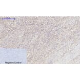 Immunohistochemistry - Anti-mTOR Antibody (B1156) - Antibodies.com