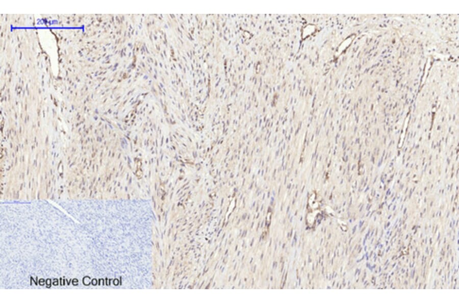 Immunohistochemistry - Anti-mTOR Antibody (B1156) - Antibodies.com