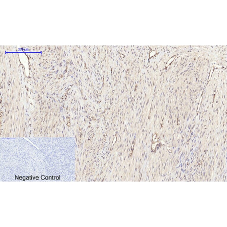 Immunohistochemistry - Anti-mTOR Antibody (B1156) - Antibodies.com