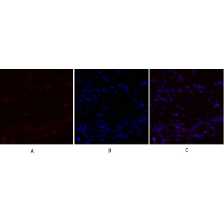 Immunofluorescence - Anti-mTOR Antibody (B1156) - Antibodies.com