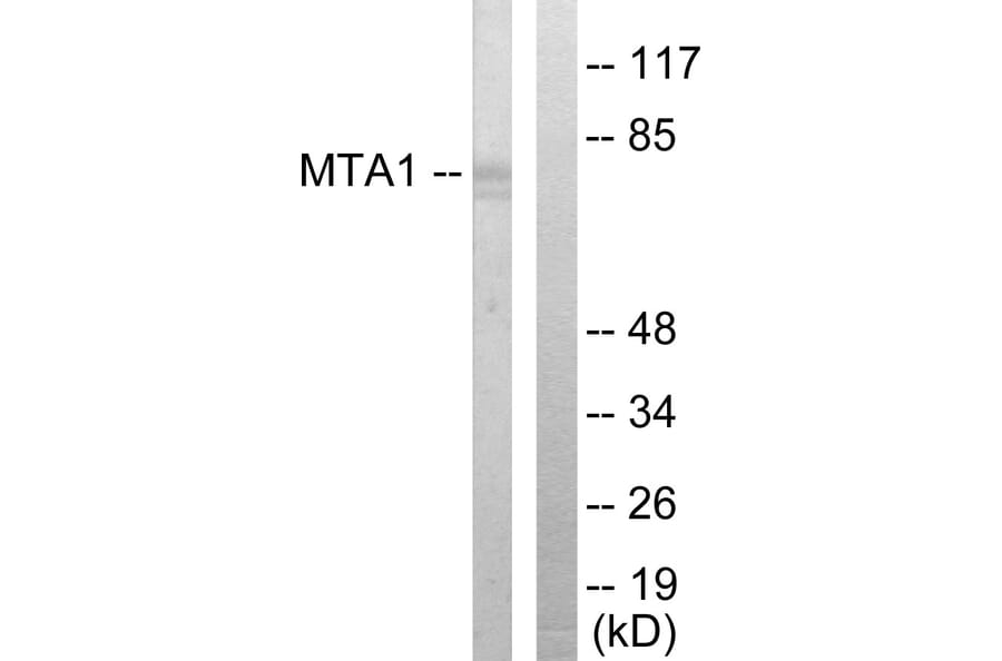 Western Blot - Anti-MTA1 Antibody (C10969) - Antibodies.com
