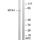 Western Blot - Anti-MTA1 Antibody (C10969) - Antibodies.com