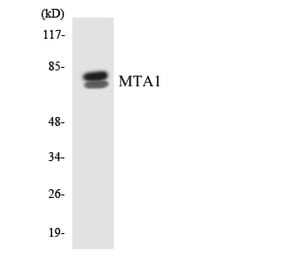 Western Blot - Anti-MTA1 Antibody (R12-3059) - Antibodies.com