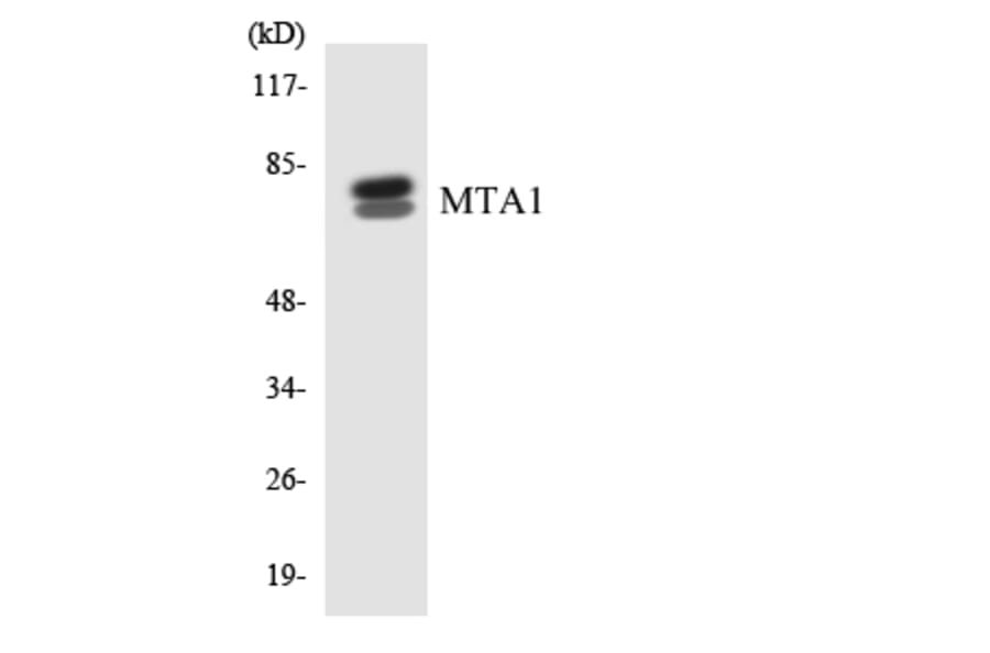 Western Blot - Anti-MTA1 Antibody (R12-3059) - Antibodies.com