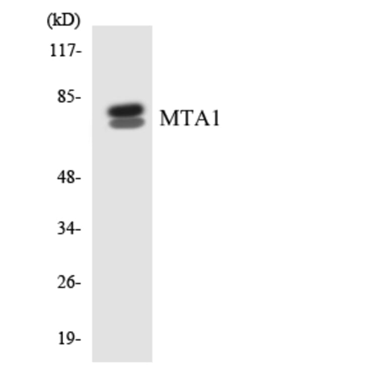 Western Blot - Anti-MTA1 Antibody (R12-3059) - Antibodies.com