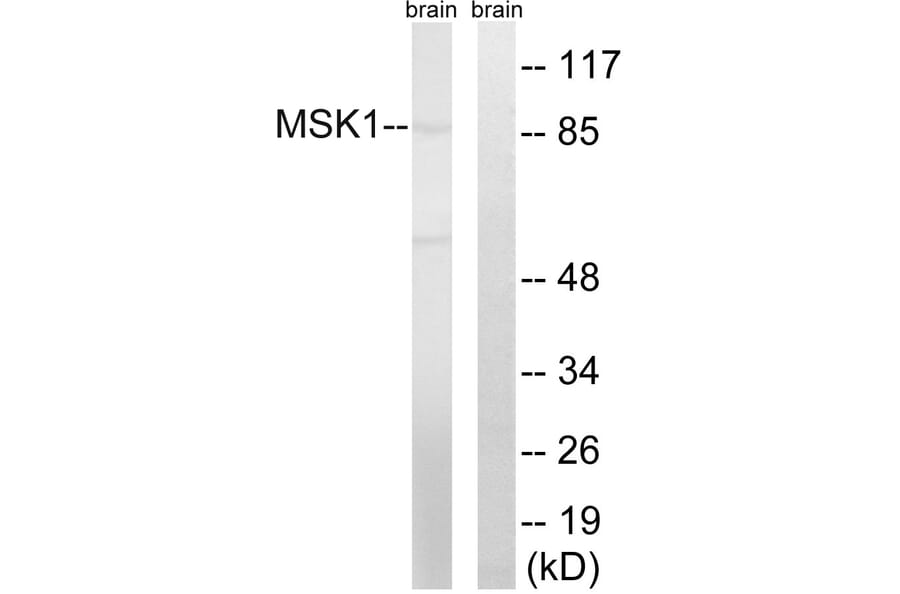 Western Blot - Anti-MSK1 Antibody (B8147) - Antibodies.com