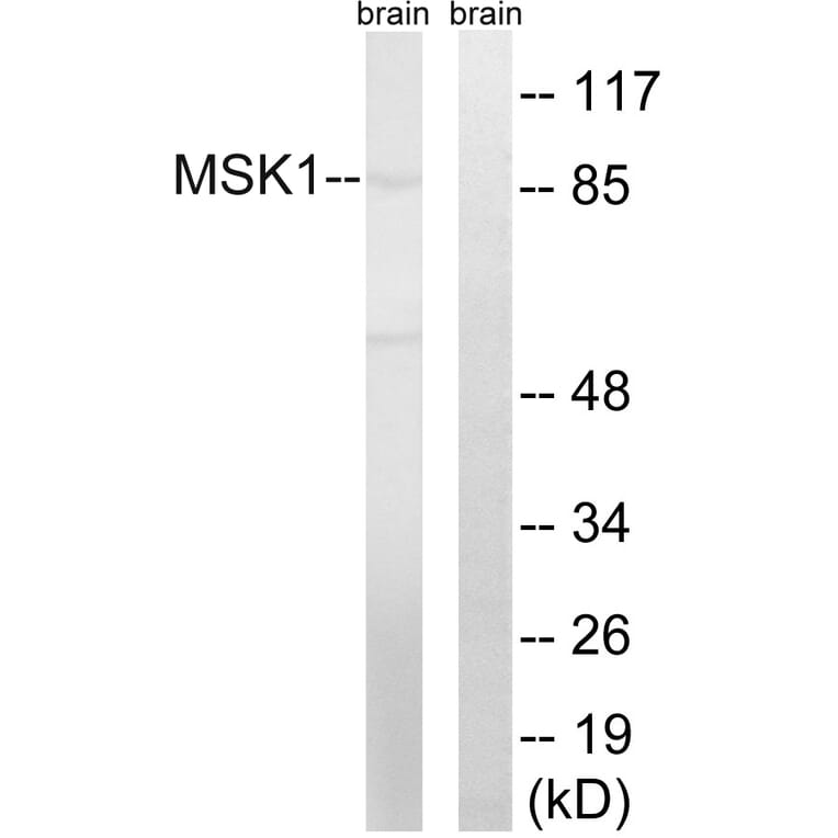 Western Blot - Anti-MSK1 Antibody (B8147) - Antibodies.com
