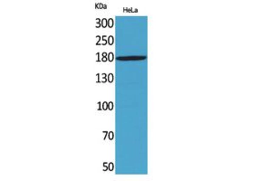Western Blot - Anti-MRC2 Antibody (C30509) - Antibodies.com