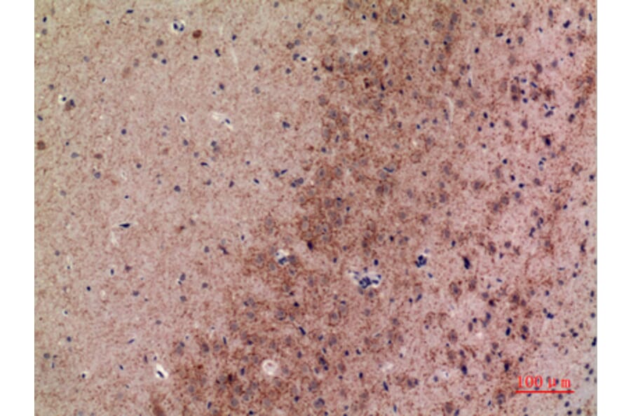 Immunohistochemistry - Anti-MRC2 Antibody (C30509) - Antibodies.com