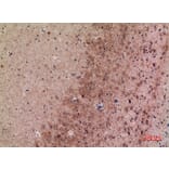 Immunohistochemistry - Anti-MRC2 Antibody (C30509) - Antibodies.com