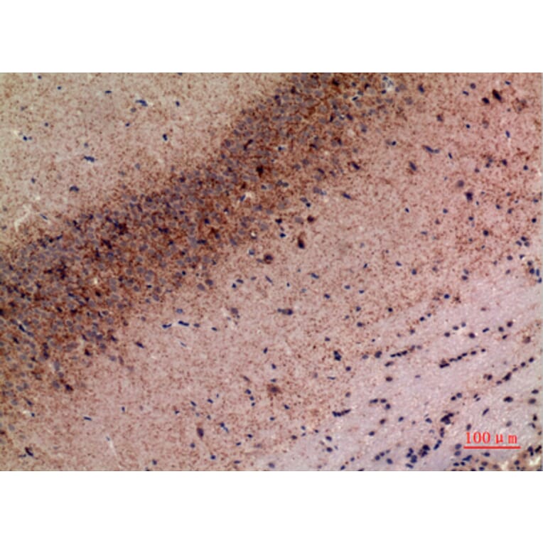 Immunohistochemistry - Anti-MRC2 Antibody (C30509) - Antibodies.com