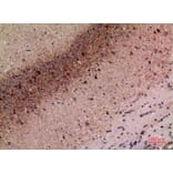 Immunohistochemistry - Anti-MRC2 Antibody (C30509) - Antibodies.com