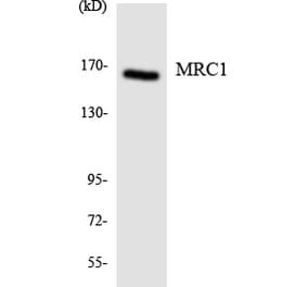Western Blot - Anti-MRC1 Antibody (R12-3029) - Antibodies.com