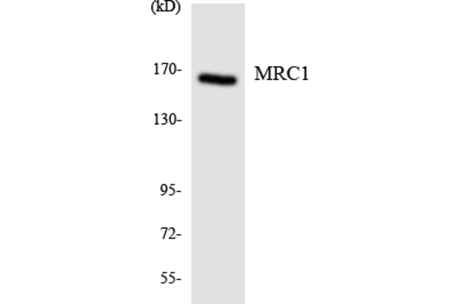 Western Blot - Anti-MRC1 Antibody (R12-3029) - Antibodies.com