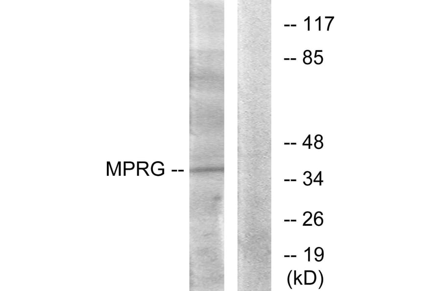 Western Blot - Anti-MPRG Antibody (G389) - Antibodies.com