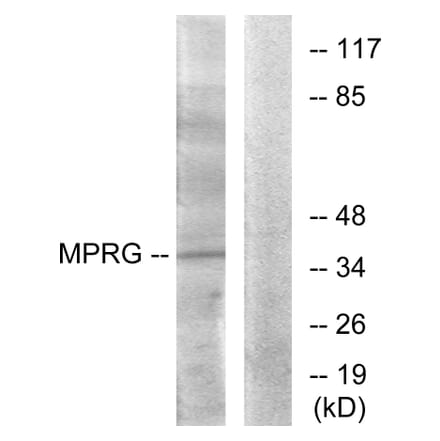 Western Blot - Anti-MPRG Antibody (G389) - Antibodies.com