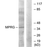 Western Blot - Anti-MPRG Antibody (G389) - Antibodies.com