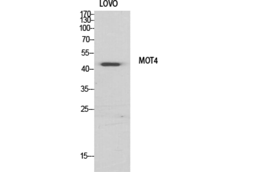 Western Blot - Anti-MOT4 Antibody (C16692) - Antibodies.com