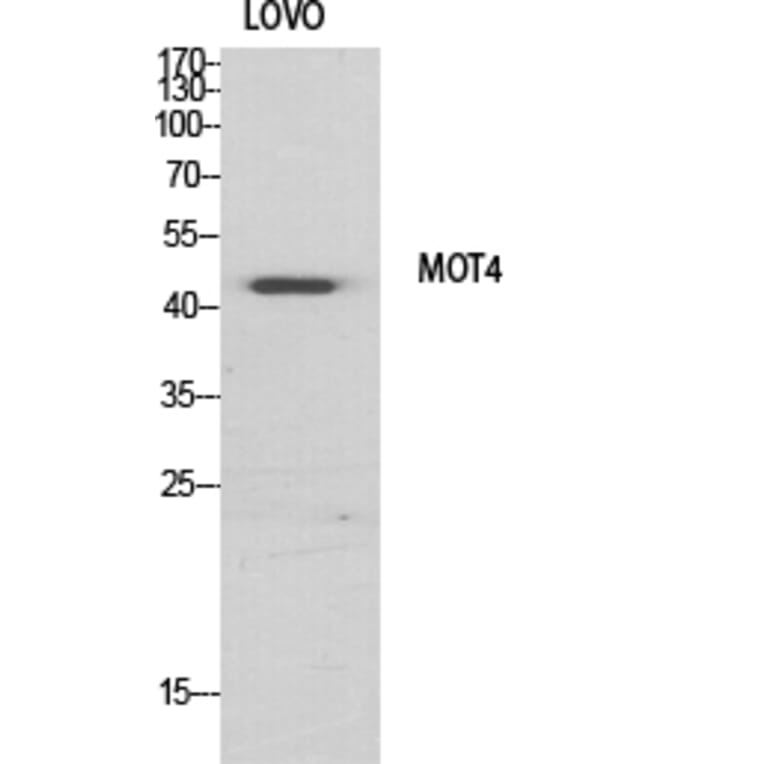 Western Blot - Anti-MOT4 Antibody (C16692) - Antibodies.com