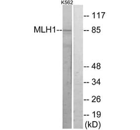 Western Blot - Anti-MLH1 Antibody (C13086) - Antibodies.com