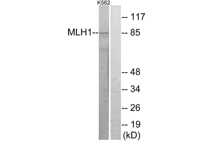 Western Blot - Anti-MLH1 Antibody (C13086) - Antibodies.com