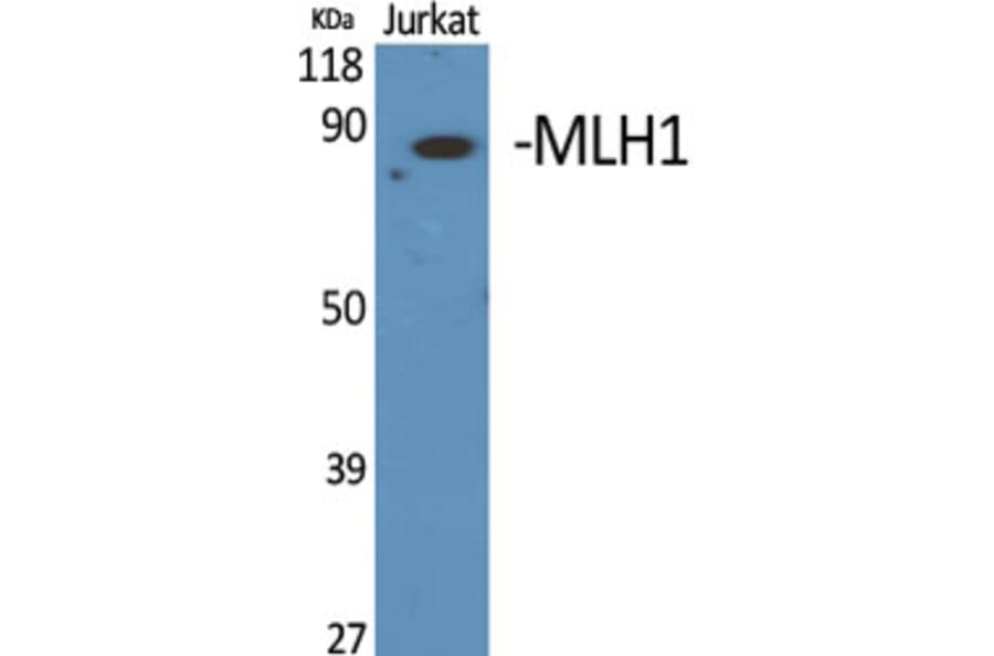 Western Blot - Anti-MLH1 Antibody (C13086) - Antibodies.com
