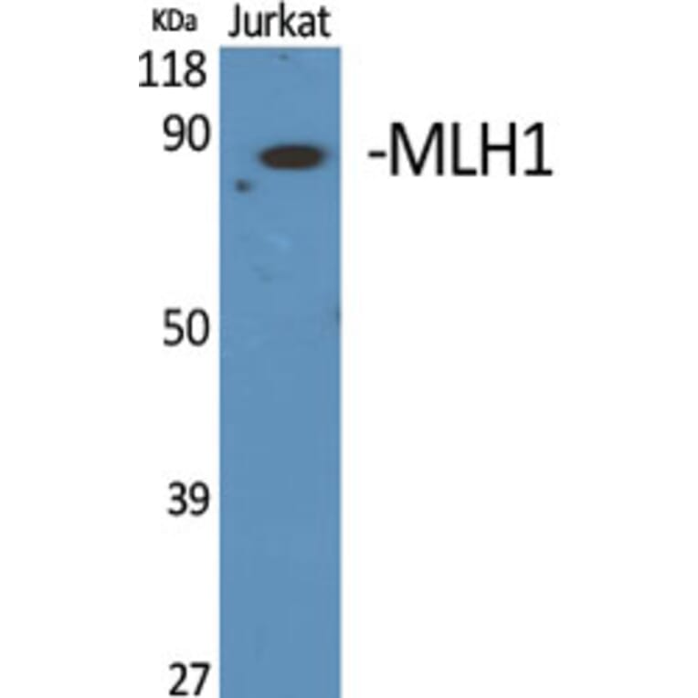 Western Blot - Anti-MLH1 Antibody (C13086) - Antibodies.com