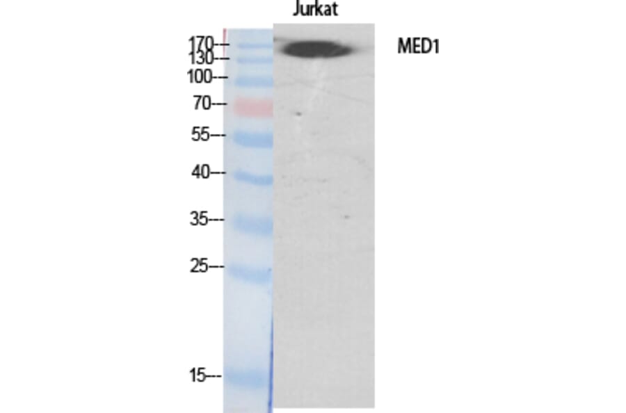 Western Blot - Anti-MED1 Antibody (C11093) - Antibodies.com