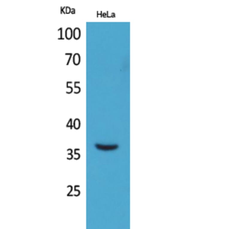 Western Blot - Anti-MCL1 Antibody (C30046) - Antibodies.com