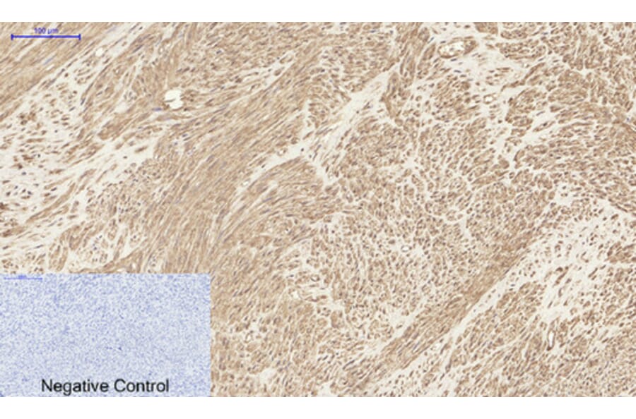 Immunohistochemistry - Anti-MCL1 Antibody (C30046) - Antibodies.com