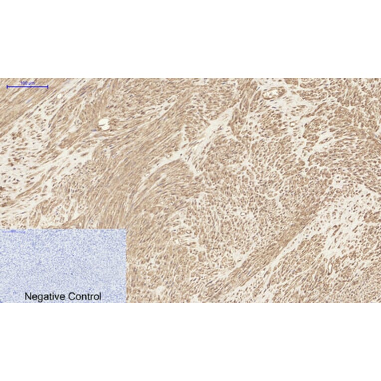 Immunohistochemistry - Anti-MCL1 Antibody (C30046) - Antibodies.com