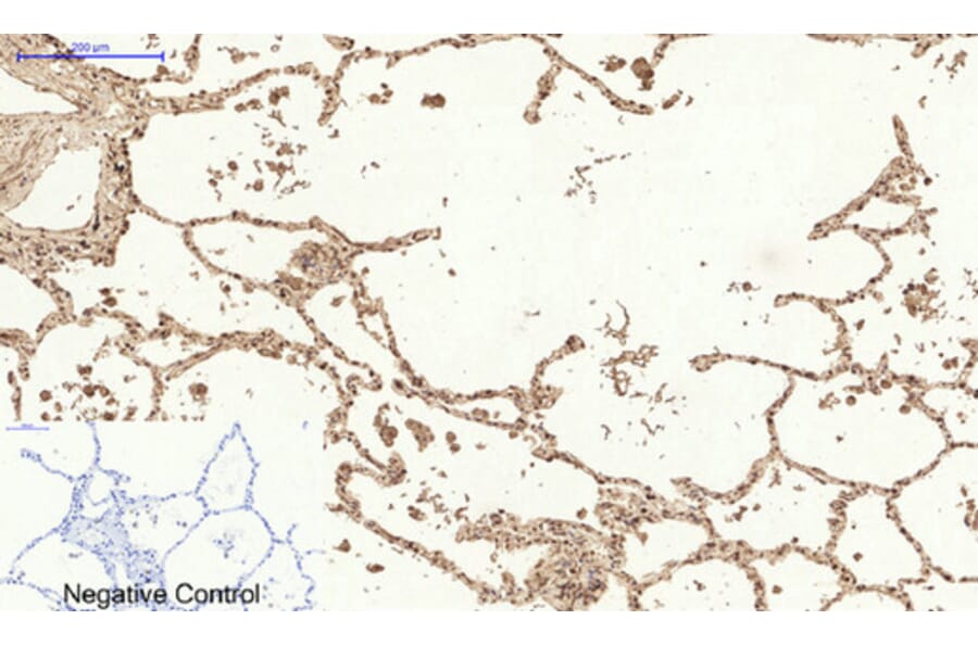 Immunohistochemistry - Anti-MCL1 Antibody (C30046) - Antibodies.com