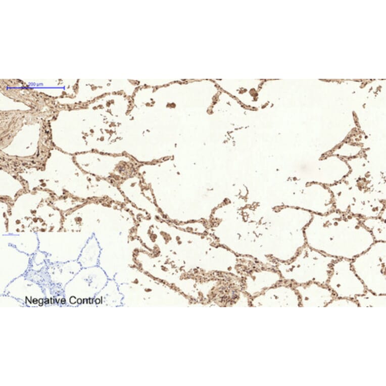 Immunohistochemistry - Anti-MCL1 Antibody (C30046) - Antibodies.com