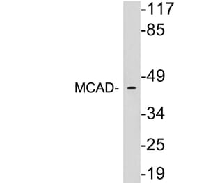 Western Blot - Anti-MCAD Antibody (R12-2235) - Antibodies.com